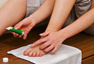 applicazione di un unguento per il trattamento del fungo dell'unghia del piede