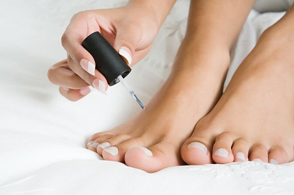 Applicazione di vernice antifungina per i funghi dell'unghia del piede