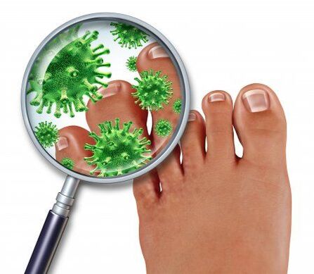 infezione fungina ai piedi